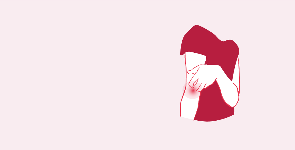 Psoriasis